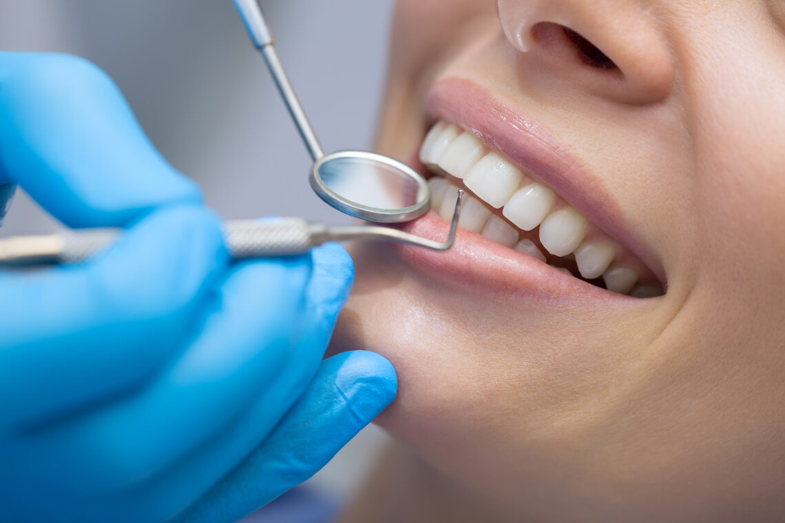 How Long Do Dental Crowns Last In New York?