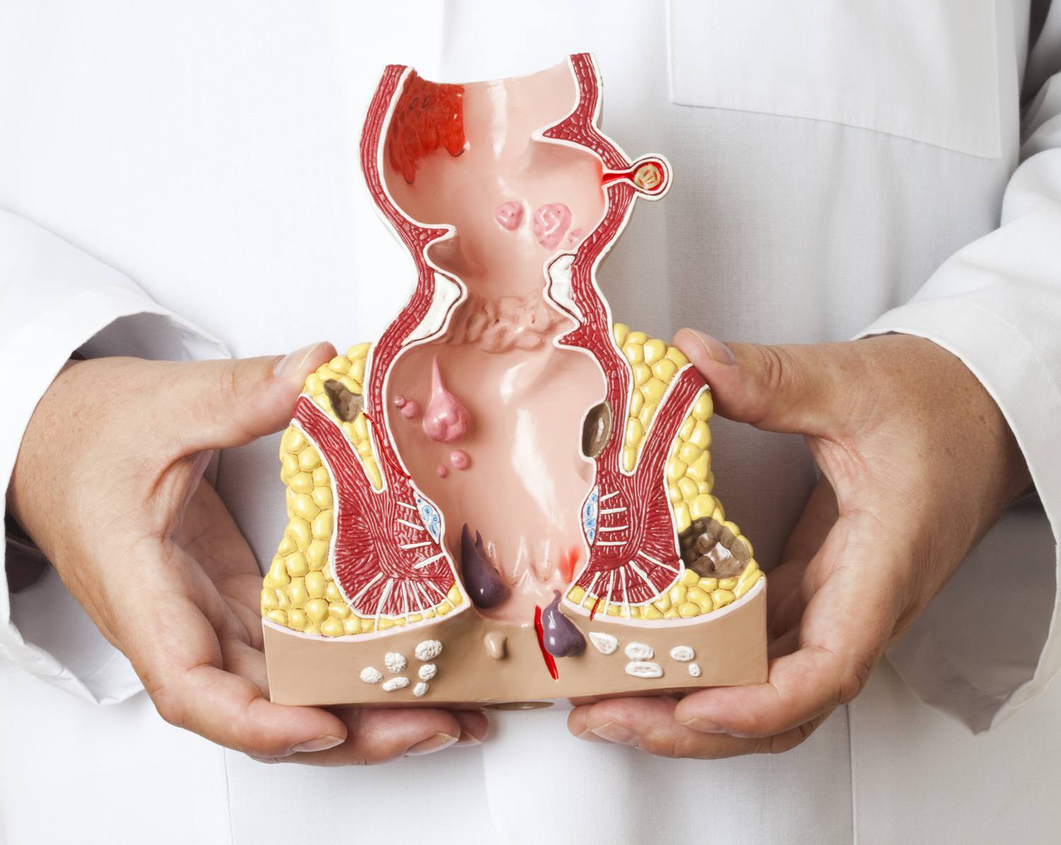 Hemorrhoid Treatment Devices Market Trends to Register Striking Growth Due to the Advanced Diagnostic Technology