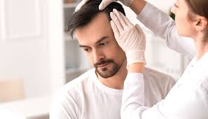 Balding and Its Effect on the Scalp Surface
