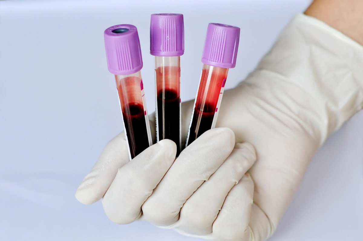 Unlock the Secrets of Health with Blood Analysis Melbourne