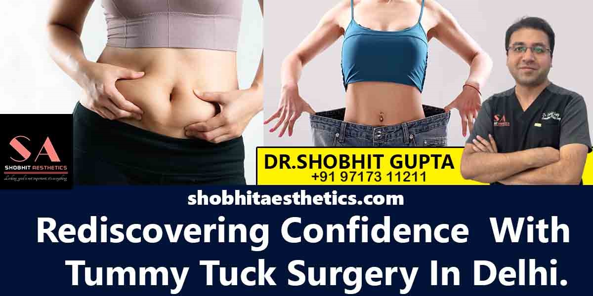 Top options for tummy tuck surgery in Delhi