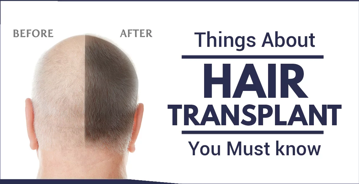 DRY HAIR: EXPLAINED BY A HAIR TRANSPLANT CLINIC IN VIZAG