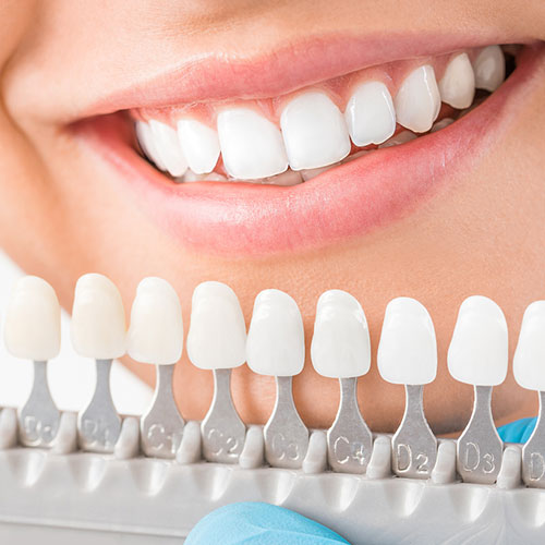أفضل قشور الأسنان للحصول على أقصى قدر من الحماية